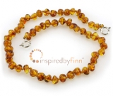 Baltic Amber Anklet - AdjustablePolished Honey Baltic Amber Anklet - AdjustablePolished Honey