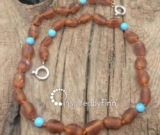 Baltic Amber Anklet - AdjustableUnpolished Blue Cider Baltic Amber Anklet - AdjustableUnpolished Blue Cider