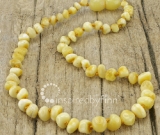 SALE - Baltic Amber Necklace - Polished Variegated - Sizes 10.5-15 SALE - Baltic Amber Necklace - Polished Variegated - Sizes 10.5-15