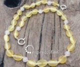 Baltic Amber Anklet - AdjustableUnpolished Lemon Rose Quartz Baltic Amber Anklet - AdjustableUnpolished Lemon Rose Quartz