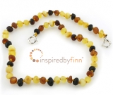 Baltic Amber Anklet - AdjustableUnpolished Diversity Baltic Amber Anklet - AdjustableUnpolished Diversity
