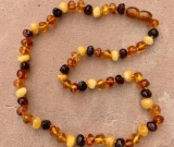 Baltic Amber Adult/Adolescent Necklace - Perfectly Imperfect Larger Beads Polished Unique 4 Diffe