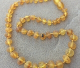 Baltic Amber Necklace - Size 10.5 - 14