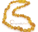 Baltic Amber Clasped AnkletUnpolished Harvest Baltic Amber Clasped AnkletUnpolished Harvest