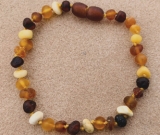 SALE! Adult/Adolescent Clasped Baltic Amber BraceletUnpolished Diversity SALE! Adult/Adolescent Clasped Baltic Amber BraceletUnpolished Diversity