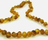 Amber Necklace - Unpolished Spotted Amber - Sizes 10.5 - 18 Amber Necklace - Unpolished Spotted Amber - Sizes 10.5 - 18